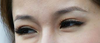 how to make double eyelid permanent